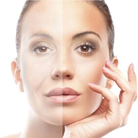 Rejuvenation of the skin of the face